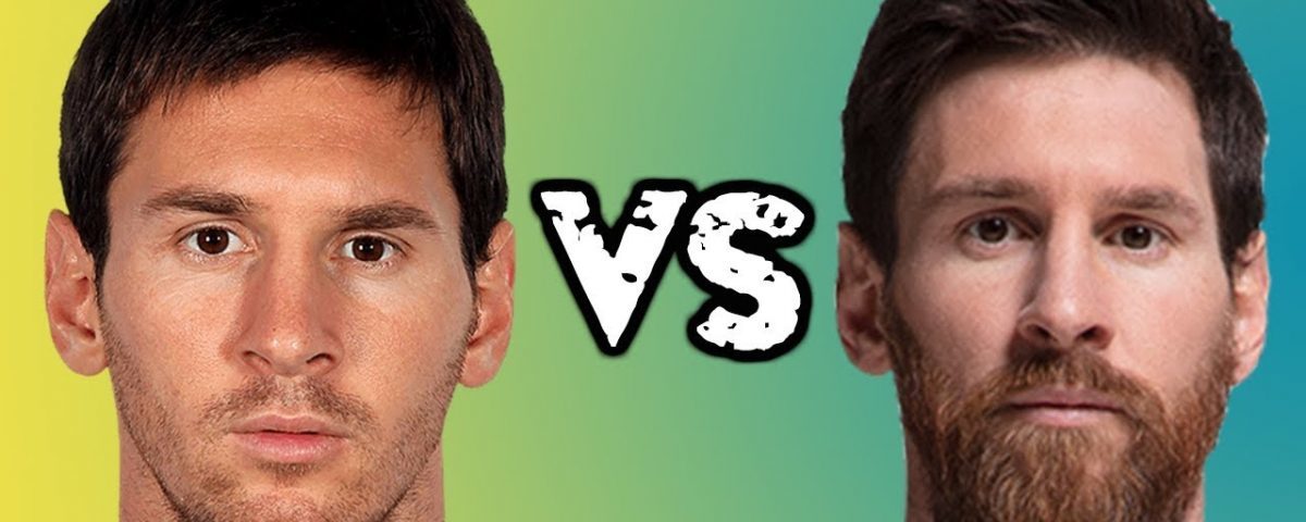 Присаждане на коса , присаждане на брадa