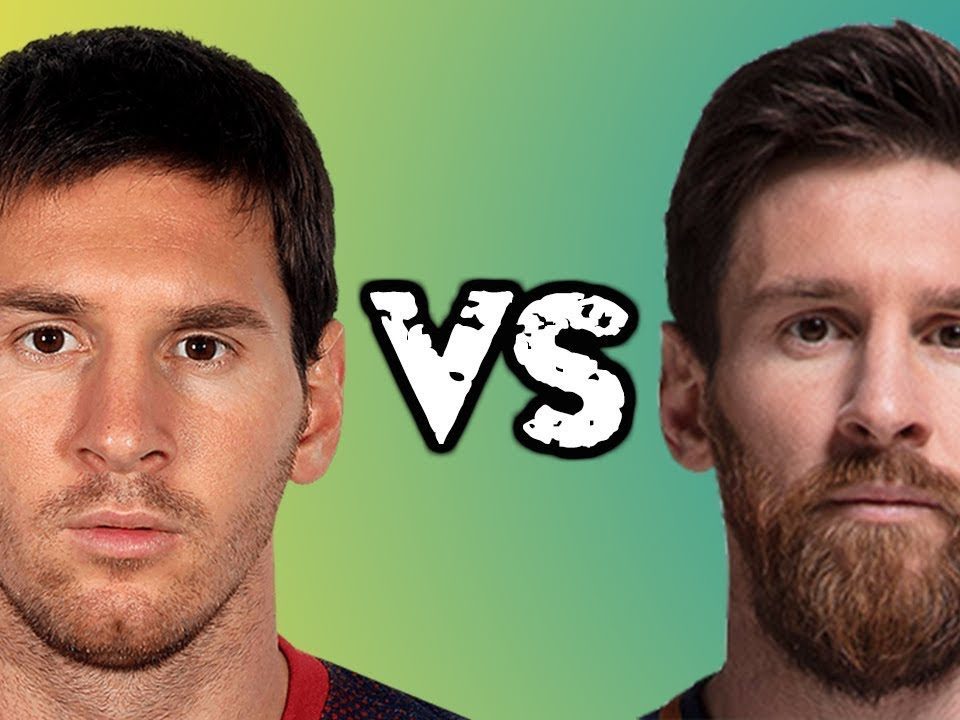 Присаждане на коса , присаждане на брадa