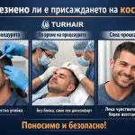 Болезнено ли е присаждането на коса – процедура с местна упойка, без болка и бързо възстановяване