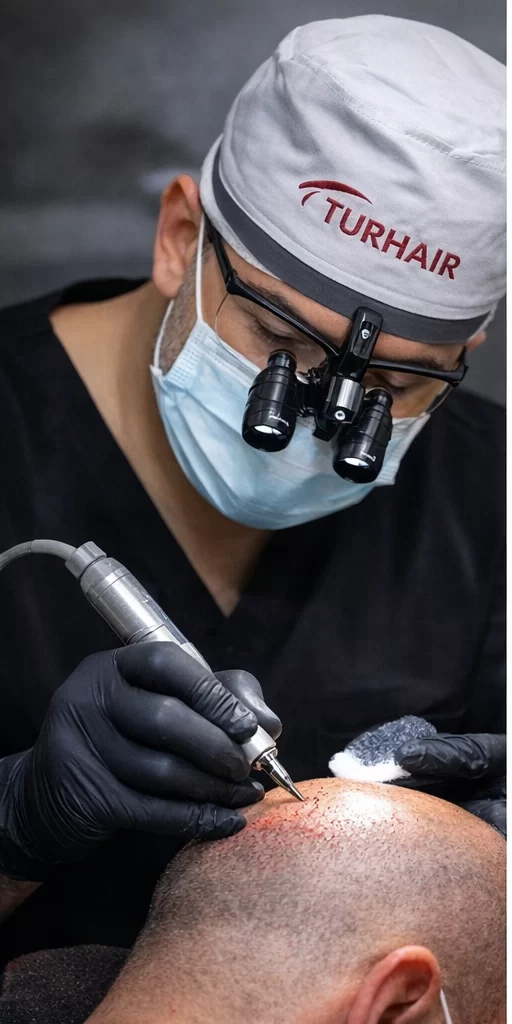 Присаждане на коса Турция – FUE графтове от д-р Демир