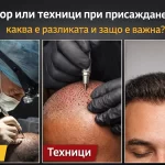 доктор или техници при присаждане на коса разлика резултат естествена линия