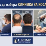 Как да избера клиника за коса – лекар участие, реални резултати и стерилна операция Turhair