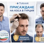 Присаждане на коса в Турция без бръснене – резултати преди и след в клиника Turhair с лекарски контрол