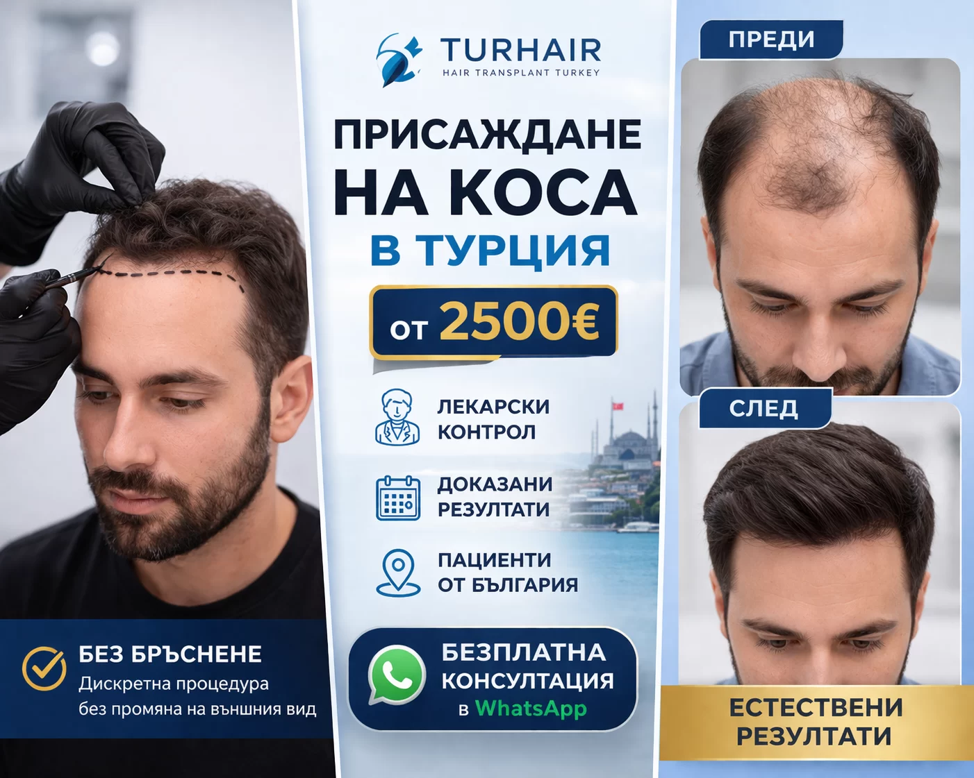 Присаждане на коса в Турция – без бръснене | Turhair