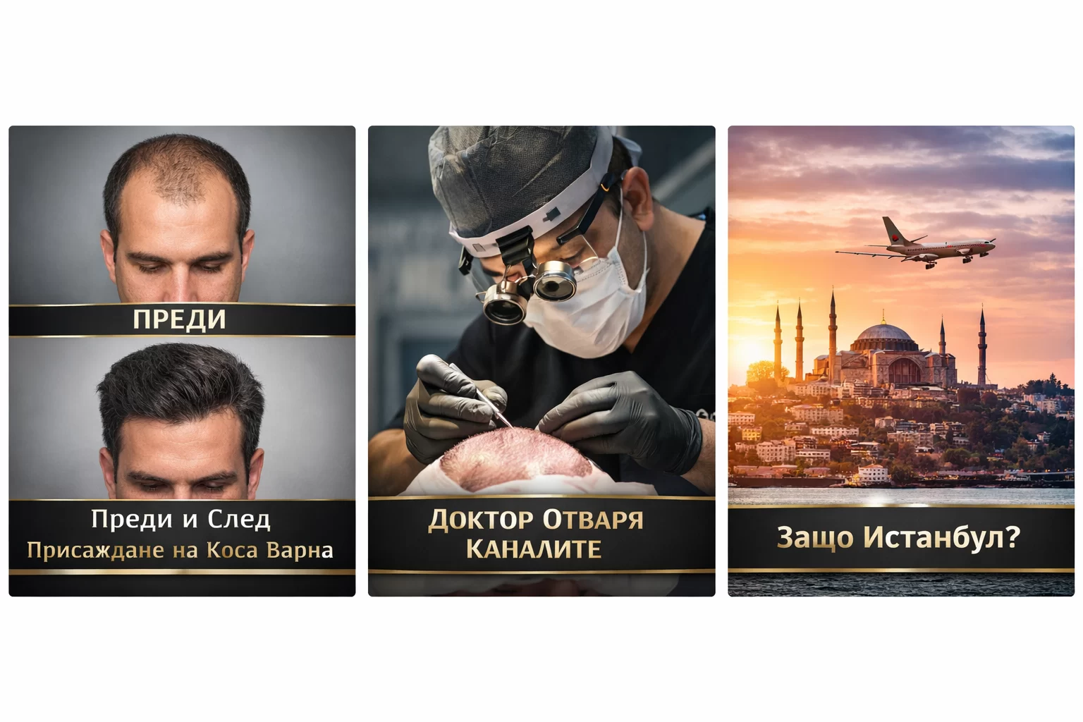 присаждане на коса варна преди след доктор отваря канали защо истанбул