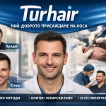 Присаждане на коса преди и след резултат Turhair FUE DHI метод докторска клиника естествена линия