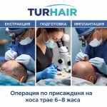 Процес на присаждане на коса в Turhair – извличане, подготовка и имплантиране на графтове от лекар