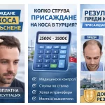 Цена на присаждане на коса в Турция 2500€ – 3500€ с медицински контрол и пакетни услуги