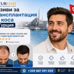 Отзиви за трансплантация на коса в Турция с TurHair – реални пациенти, снимки преди и след процедурата и естествени резултати.
