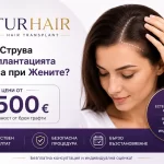 Колко струва трансплантацията на коса при жените в Турция – TURHAIR Istanbul