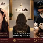 Женска трансплантация на коса в Турция в TurHair с Dr. Demir за естествена плътност и женствена линия на косата