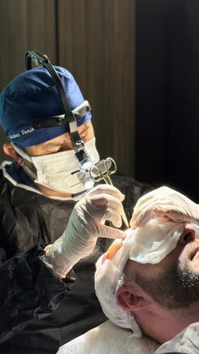 kanali-otvariane-transplantacia-kosa-lekar-turhair-dr-demir